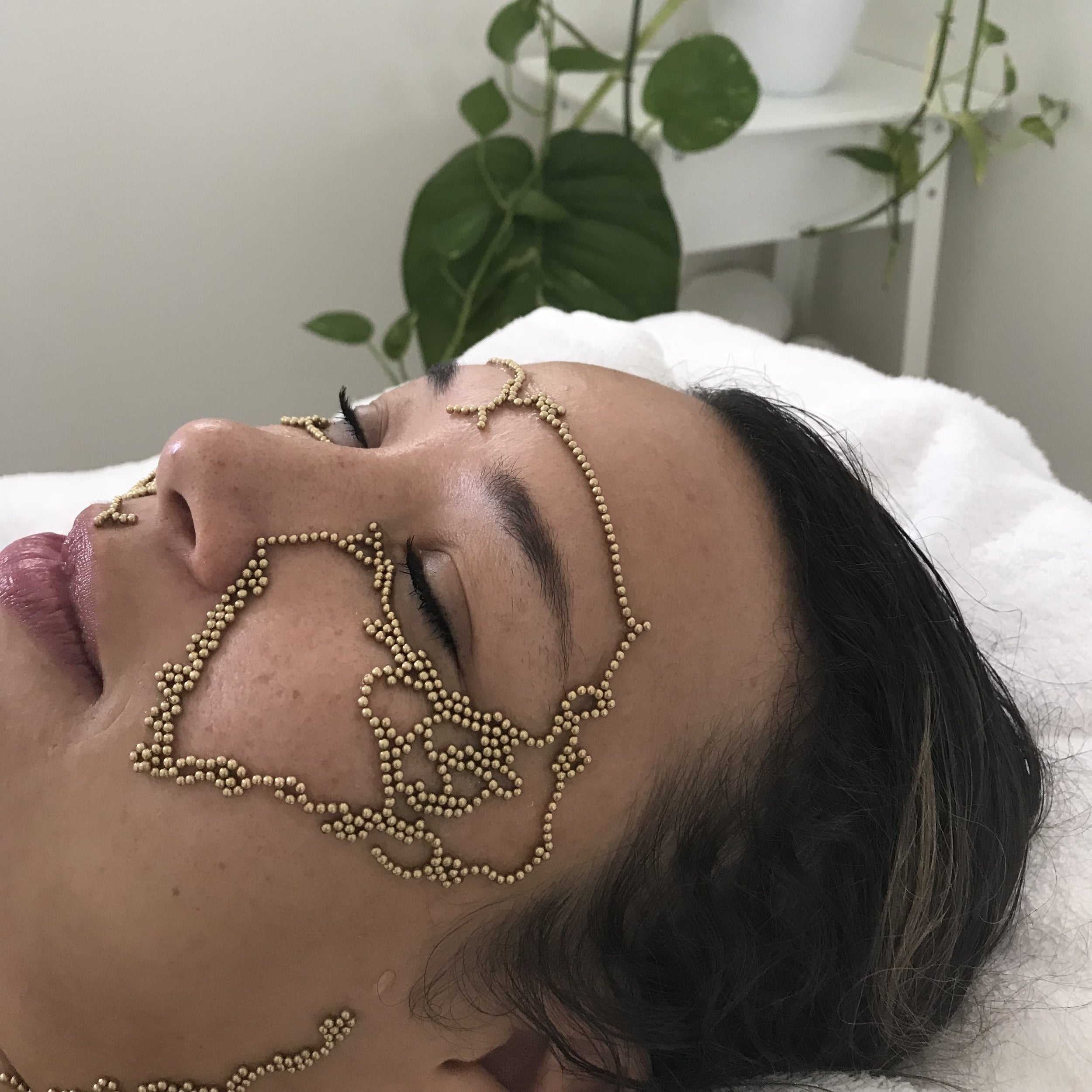 B // Treatment #1, before and after Qi beauty Facial Treatment