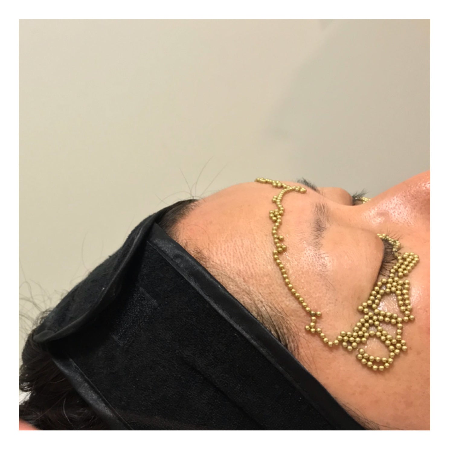 How To_ Treat fine lines and crows feet